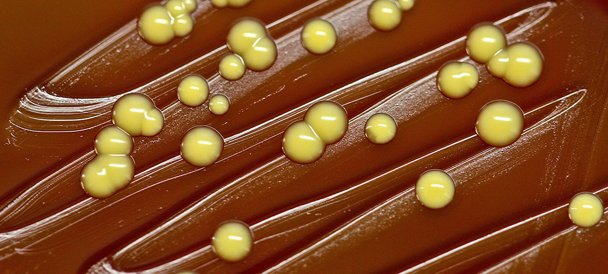 1 2 какие микробы живут на телефоне