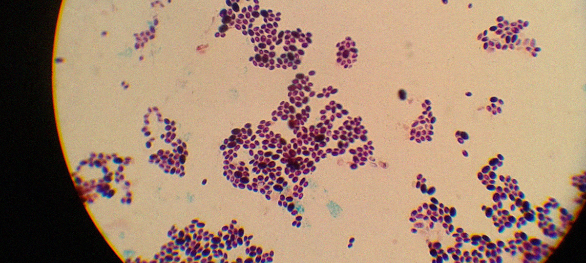 1 6 какие микробы живут на телефоне